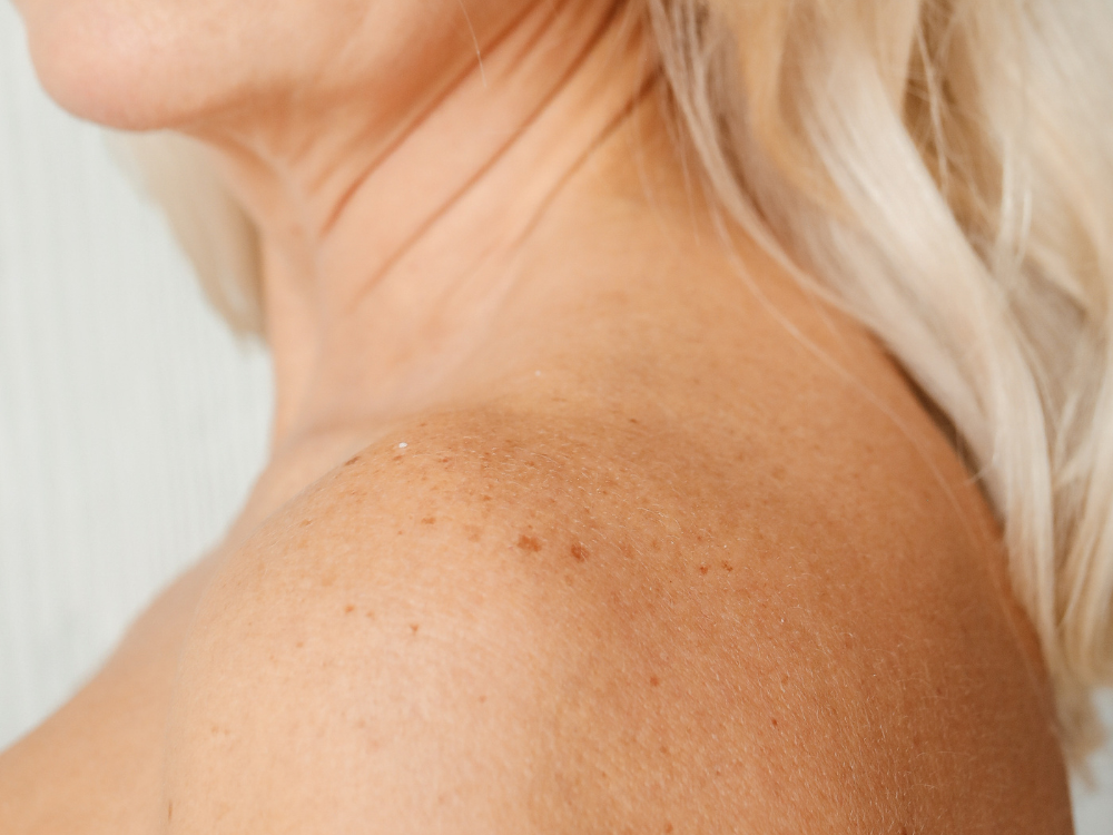 Dark Spots & Brightening
